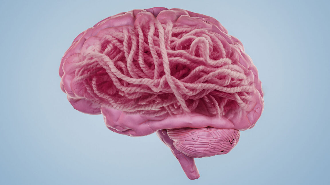 Alzheimer Araştırmalarında Deprem: Amiloid Hipotezi Çöküyor mu?