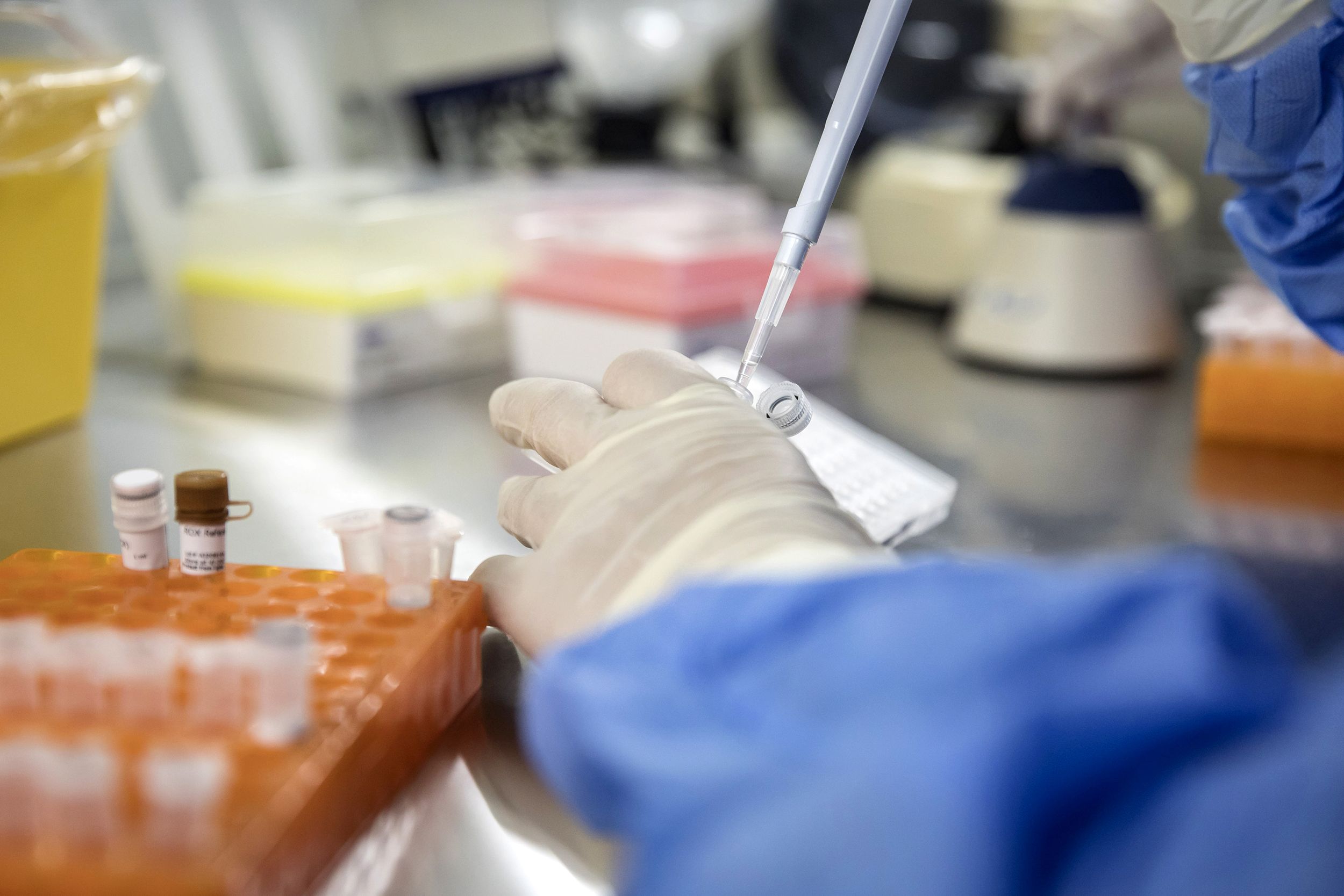 Kanser Tedavisinde Kullanılan CAR-T Hücre Terapisi HIV İçin Umut Oluyor