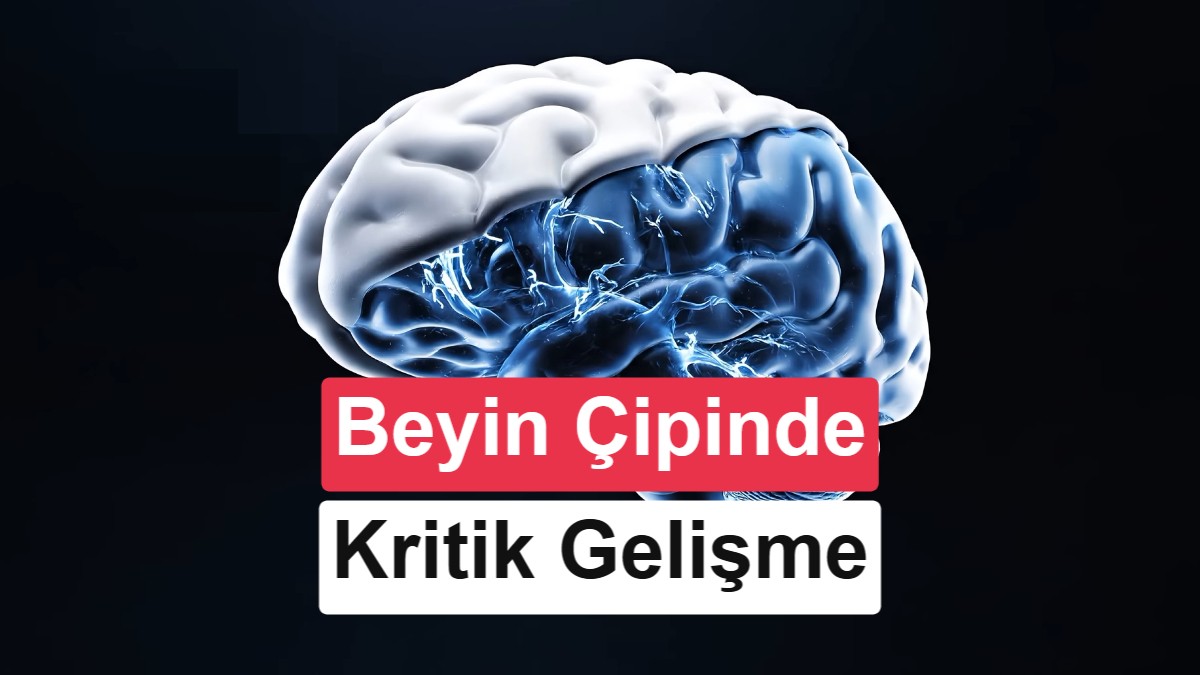 Neuralink'ten Başarı: Beyin Zarı Kesilmeden Çip Takıldı