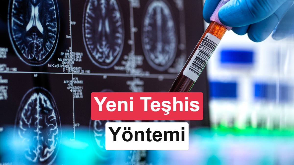 Alzheimer Teşhisinde Yeni Dönem: FDA'dan İki Yeni Kan Testine Onay